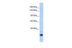 ZNF197 Rabbit anti-Human, Polyclonal, Novus Biologicals 0.1 mL | Buy Online | Novus Biologicals | Fisher Scientific